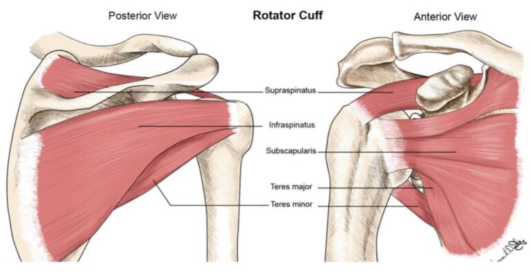 Rotator cuff